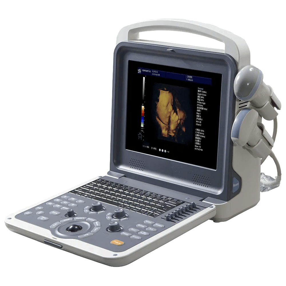 12-Inch High Resolution LED Color Doppler Ultrasound Machine