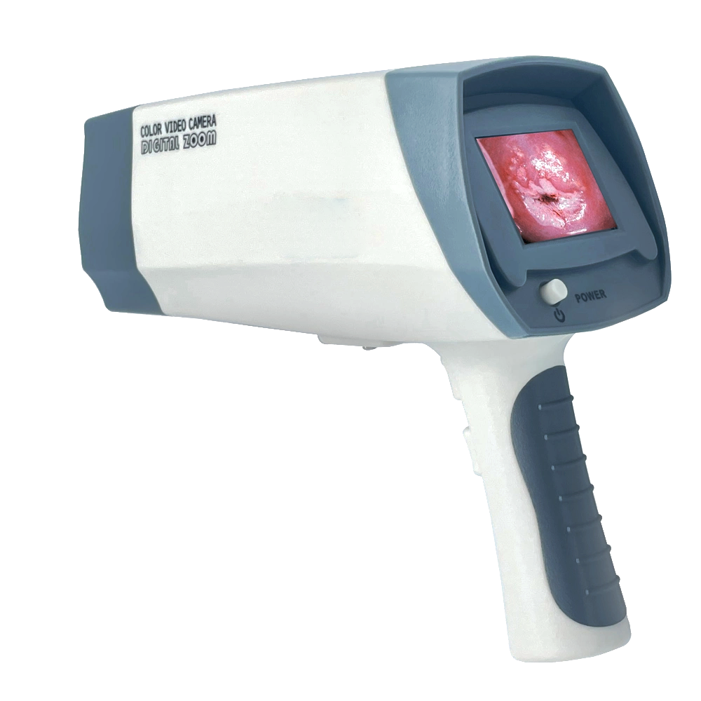 Medical Gynecology Equipment Digital Optical Colposcope Machine