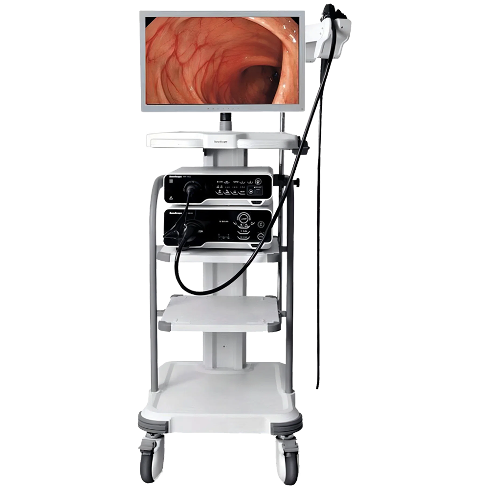 Sonoscape Endoscopy Machine Medical Gastroscope Colonoscope Bronchoscope