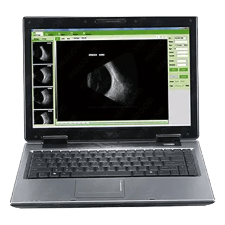 Ophthalmic A and B scanner
